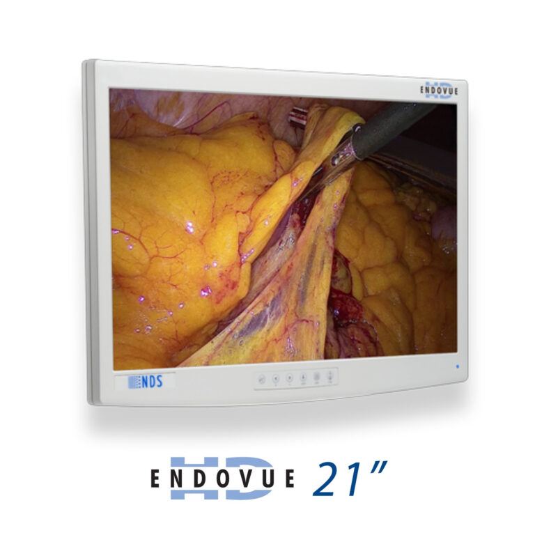 EndoVue
