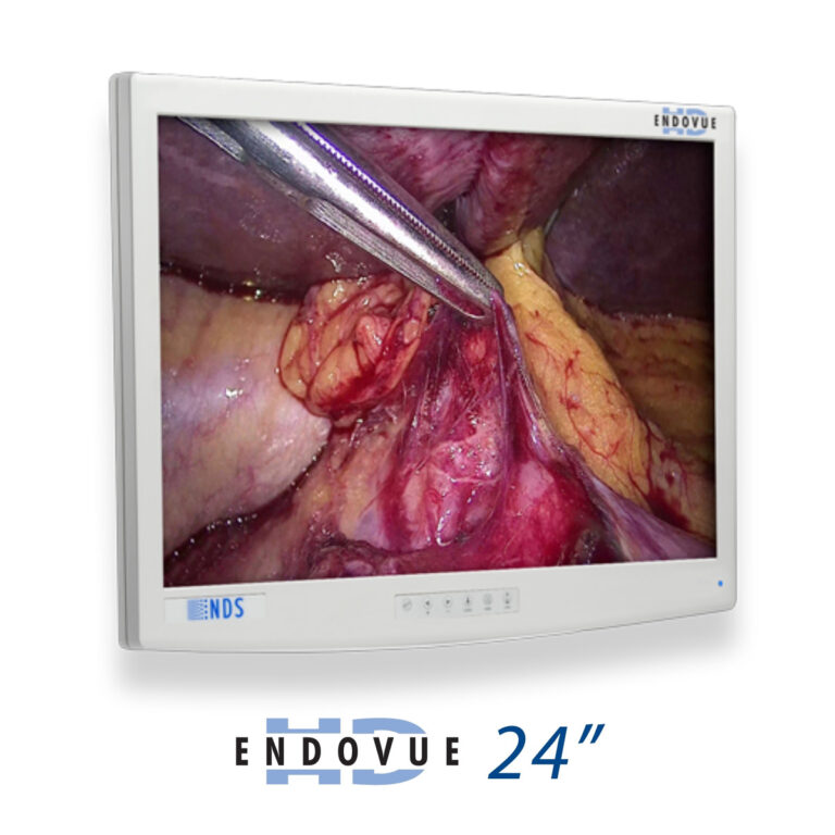 EndoVue