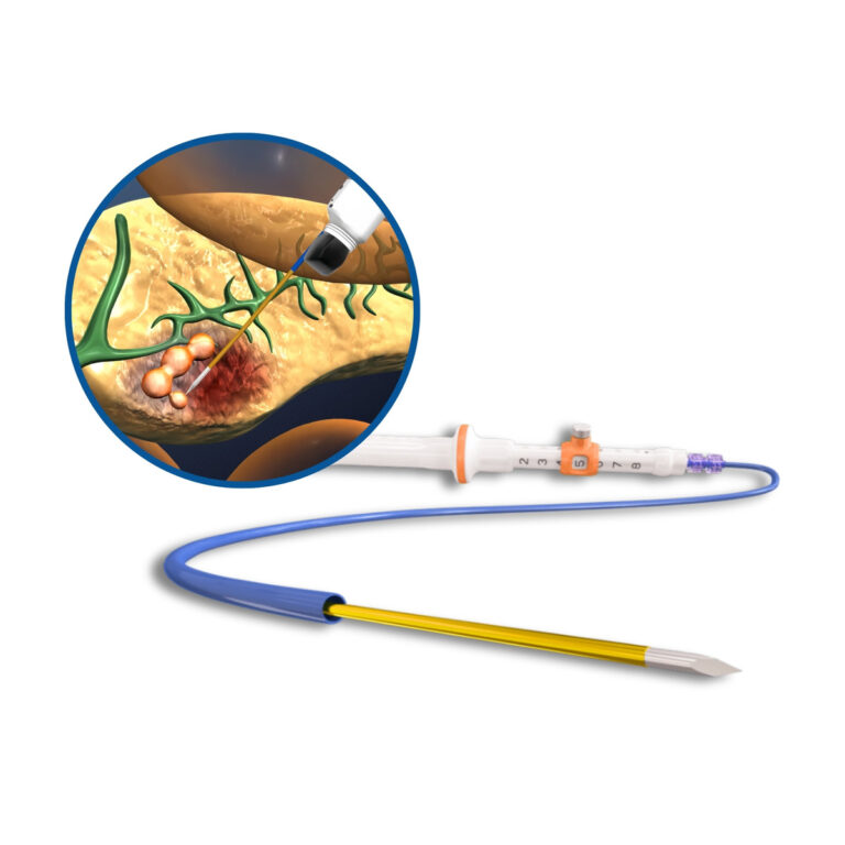 Kim chích RFA EUSRA