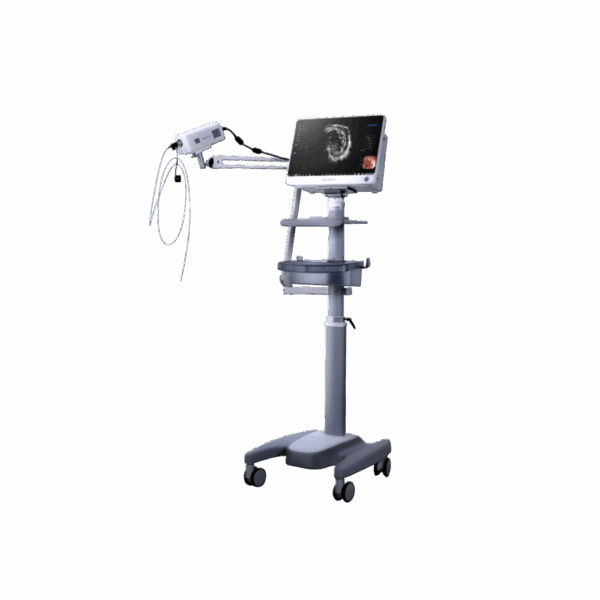 Hệ thống siêu âm nội soi